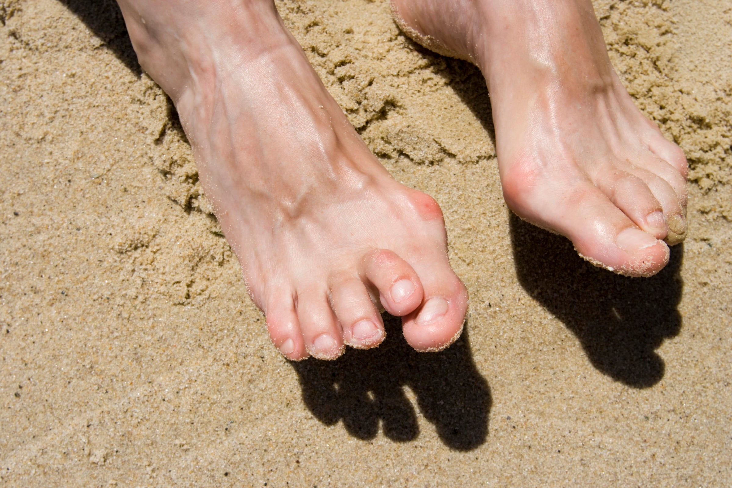 Bare feet in sand, visible hammer toes on both feet